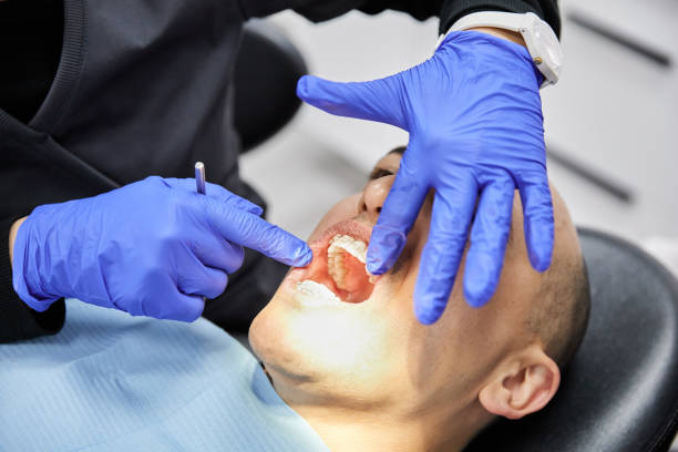 Best Emergency Wisdom Teeth Removal in La Palma, CA