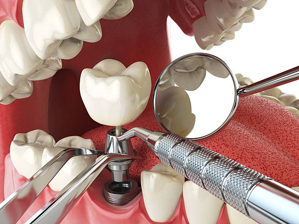 Best Weekend Emergency Dentist in La Palma, CA